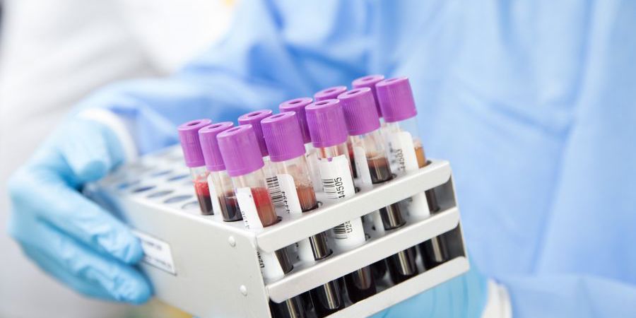 Peth Blood Alcohol Test Blog