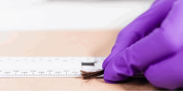 Knowledgehub Interpreting Drug And Alcohol Results